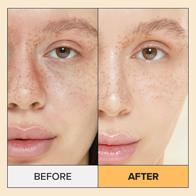 I DEW CARE Real Herb Calendula Sheet Face Mask - Hot As Sheet | Korean Face Masks Skincare, Moisturizing and Calming for Dry Skin with Calendula Flower Extract, 2% Niacinamide, 10EA