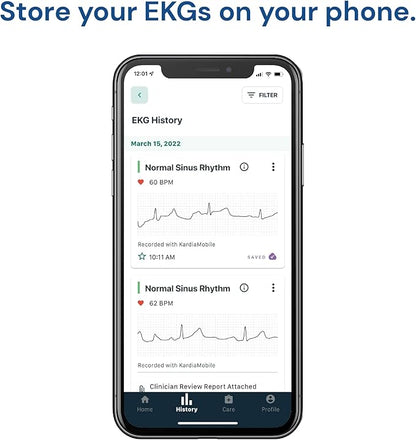 KardiaMobile 1-Lead Personal EKG Monitor – Record at Home – Detects AFib & Irregular Arrhythmias – Easy Results in 30 Seconds – Works w/Most Smartphones