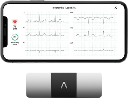 KardiaMobile 6-Lead Personal EKG Monitor – Six Views of The Heart – Detects AFib and Irregular Arrhythmias – Instant Results in 30 Seconds – Works with Most Smartphones