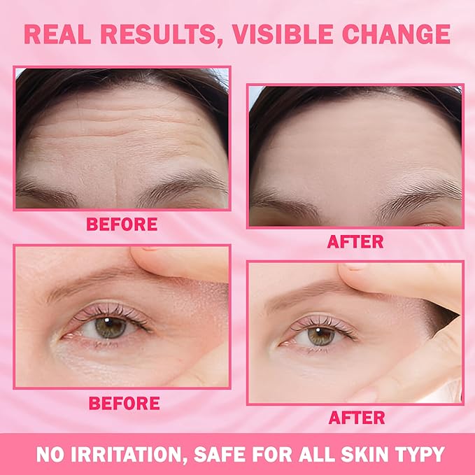 Forehead & Eye Wrinkle Patches - 20 Set Facial Wrinkle Ptaches for Reducing Fine Lines and Wrinkles, Boosts Skin Hydration & Elasticity, for All Skin Type Woman Man - Scarlet