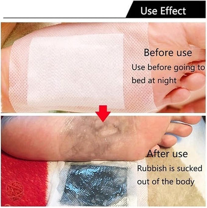 Ginger Foot Pads 100 Packs Bamboo Vinegar Patch Gold Foot Patches Easy to use