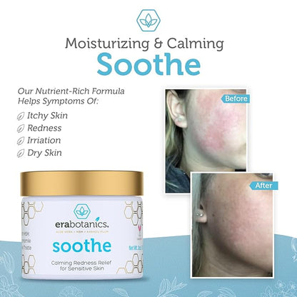 Era Organics Cream Redness Relief Moisturizer- Soothing Redness Relief for Face with Manuka Honey, MSM, Chamomile - Calming Moisturizer Made in USA