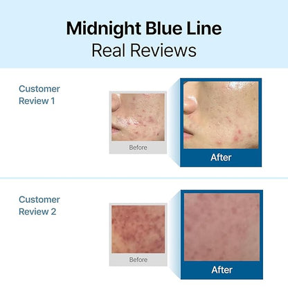 DearKlairs Midnight Blue Calming Cream – Soothing Face Moisturizer for Oily & Sensitive Skin, Redness Relief & Hydrating, Lightweight Texture, 2 Fl Oz