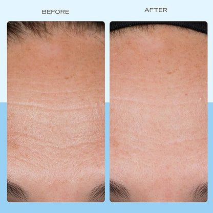 First Aid Beauty Firming Collagen Cream with Collagen, Peptides and Niacinamide – Day + Night Anti-Aging Face Moisturizer – 1.7 fl oz