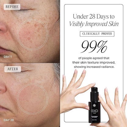 EXO FACE® - Exoceuticals Perfection Moisturizer | Hydrating Face Moisturizer | Innovative Exosome Skin Care Solutions | 50ML (1.7 fl oz.)